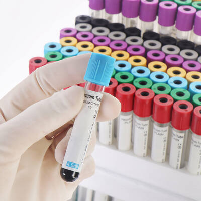 kopen Vacuum EDTA Blood Tubes for Complete Blood Count (CBC) – High Quality, Secure Seal online vervaardiging